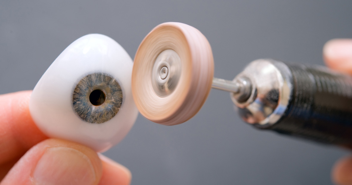 prothèse oculaire